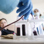 Сосуды? Заменим!