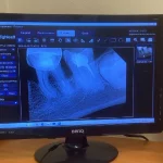 В стоматологическом отделении рязанской городской поликлиники № 2 обновили оборудование