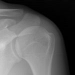 За неделю в травмцентре рязанской БСМП оказали помощь 549 пациентам