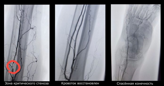 J1D6QywC8tL0U0vNJObWdw32HSmqaf62611JAOSaTQ2ZY_Bcys0daD4iyUmY8mtVxnDcvOadTqmlPwd0ifgNDgu5