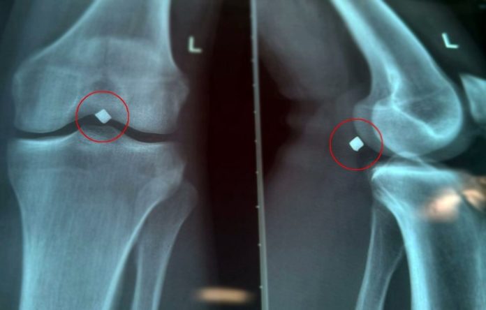 i9Tk2EuEz1bK6Wyh3W0l9hWfZ5vl5fNkb6svFnXEmAx5Ir_66uN4KVFaYWwU8GGfalIWFffDvLnbvO5_9gwaR_LT