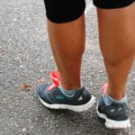 Специалист расскажет рязанцам о заболеваниях вен нижних конечностей